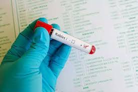 Rabies जल्द ही नोटिफ़ाएबल बीमारी होगी: Delhi minister