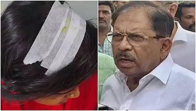 Bengaluru में ओम शक्ति मालाधारियों पर पथराव; तीन लड़के गिरफ्तार; स्थिति नियंत्रण में Bengaluru में ओम शक्ति मालाधारियों पर पथराव; तीन लड़के गिरफ्तार; स्थिति नियंत्रण में