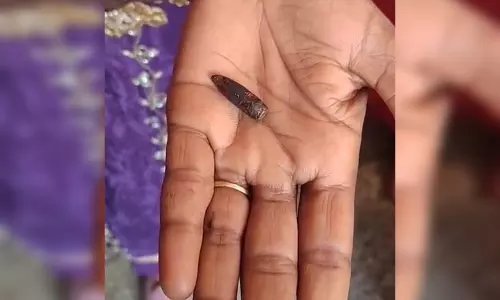 12 साल की बच्ची को लगी थी एसएलआर की गोली, 32 साल की उम्र में चला पता 12 साल की बच्ची को लगी थी एसएलआर की गोली, 32 साल की उम्र में चला पता