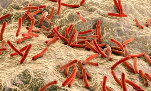 Leprosy ; घर-घर जाकर इलाज का अभियान कल से शुरू होगा