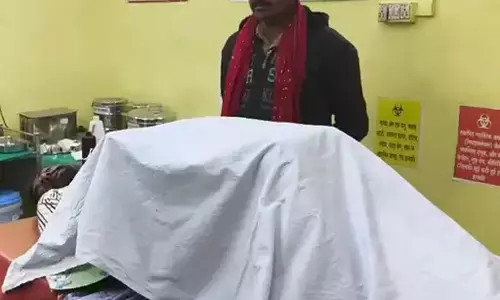गर्लफ्रेंड को डराने के लिए बॉयफ्रेंड ने खुद को आग लगाई, प्रेमिका भी झुलसी गर्लफ्रेंड को डराने के लिए बॉयफ्रेंड ने खुद को आग लगाई, प्रेमिका भी झुलसी