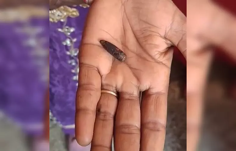 12 साल की बच्ची को लगी थी एसएलआर की गोली, 32 साल की उम्र में चला पता 12 साल की बच्ची को लगी थी एसएलआर की गोली, 32 साल की उम्र में चला पता