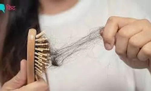 Hair Care : सर्दियों में बालों के झड़ने से परेशान हैं, ये टिप्स आपकी मदद करेंगे