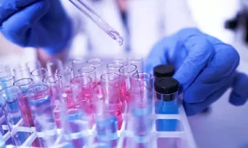 Jalandhar: फ़ूड सेफ़्टी टीम ने 6 फ़ूड सैंपल इकट्ठा किए