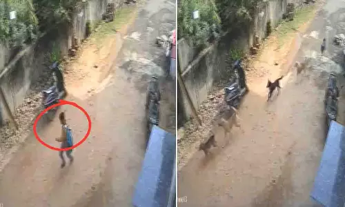 Gwalior: स्कूल जाने वाले लड़के पर 12 से ज़्यादा कुत्तों ने किया हमला Gwalior: स्कूल जाने वाले लड़के पर 12 से ज़्यादा कुत्तों ने किया हमला