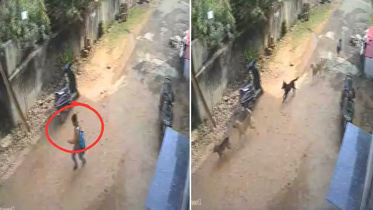 Gwalior: स्कूल जाने वाले लड़के पर 12 से ज़्यादा कुत्तों ने किया हमला Gwalior: स्कूल जाने वाले लड़के पर 12 से ज़्यादा कुत्तों ने किया हमला