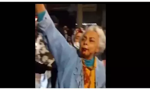 Iran में बुज़ुर्ग महिला का खूनी विरोध प्रदर्शन वायरल हो गया