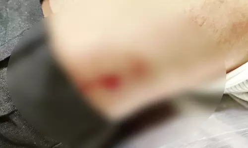 मौदहापारा में 15 गुंडों ने नशे में चाकू मारा, पीड़ित की हालत नाजुक