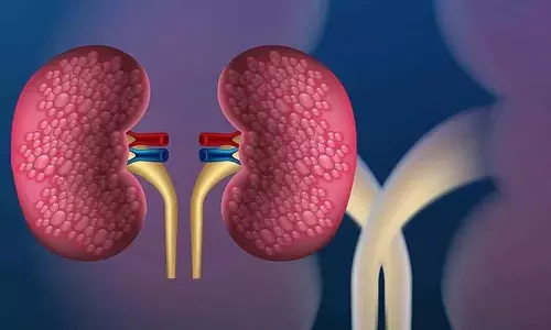 अगर आपके शरीर में ये लक्षण दिखें तो आपकी Kidney की सेहत ठीक नहीं अगर आपके शरीर में ये लक्षण दिखें तो आपकी Kidney की सेहत ठीक नहीं