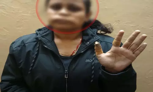 लाखेनगर में चाइनीज मांजे से महिला घायल, मकर संक्रांति से पहले कार्रवाई की उठी मांग लाखेनगर में चाइनीज मांजे से महिला घायल, मकर संक्रांति से पहले कार्रवाई की उठी मांग