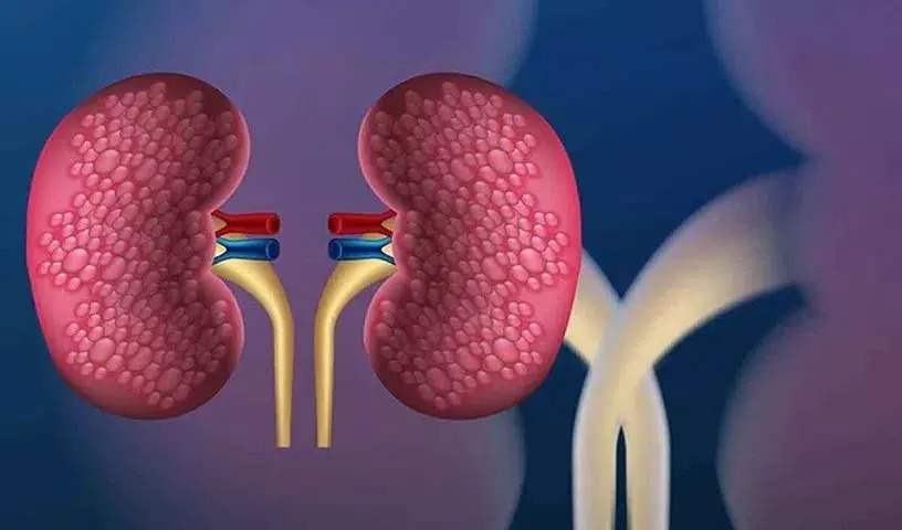 अगर आपके शरीर में ये लक्षण दिखें तो आपकी Kidney की सेहत ठीक नहीं अगर आपके शरीर में ये लक्षण दिखें तो आपकी Kidney की सेहत ठीक नहीं