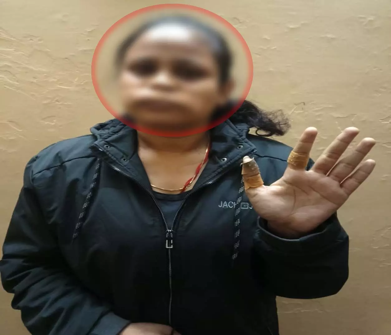 लाखेनगर में चाइनीज मांजे से महिला घायल, मकर संक्रांति से पहले कार्रवाई की उठी मांग लाखेनगर में चाइनीज मांजे से महिला घायल, मकर संक्रांति से पहले कार्रवाई की उठी मांग