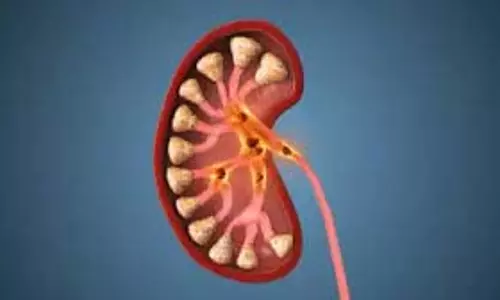 Health: रोज़ पानी कम पीने की आदत बना सकती है आपको किडनी स्टोन का मरीज Health: रोज़ पानी कम पीने की आदत बना सकती है आपको किडनी स्टोन का मरीज