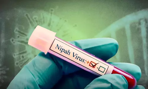 Kolkata: बंगाल में निपाह वायरस के मामले, स्वास्थ्य विभाग ने चेतावनी जारी की Kolkata: बंगाल में निपाह वायरस के मामले, स्वास्थ्य विभाग ने चेतावनी जारी की
