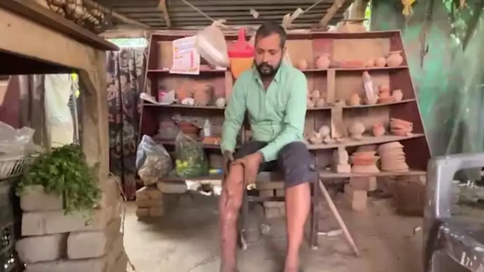इंसानियत के लिए क्या सरकार के पास 10 लाख नहीं, घोटाले हो रहे करोड़ों के इंसानियत के लिए क्या सरकार के पास 10 लाख नहीं, घोटाले हो रहे करोड़ों के