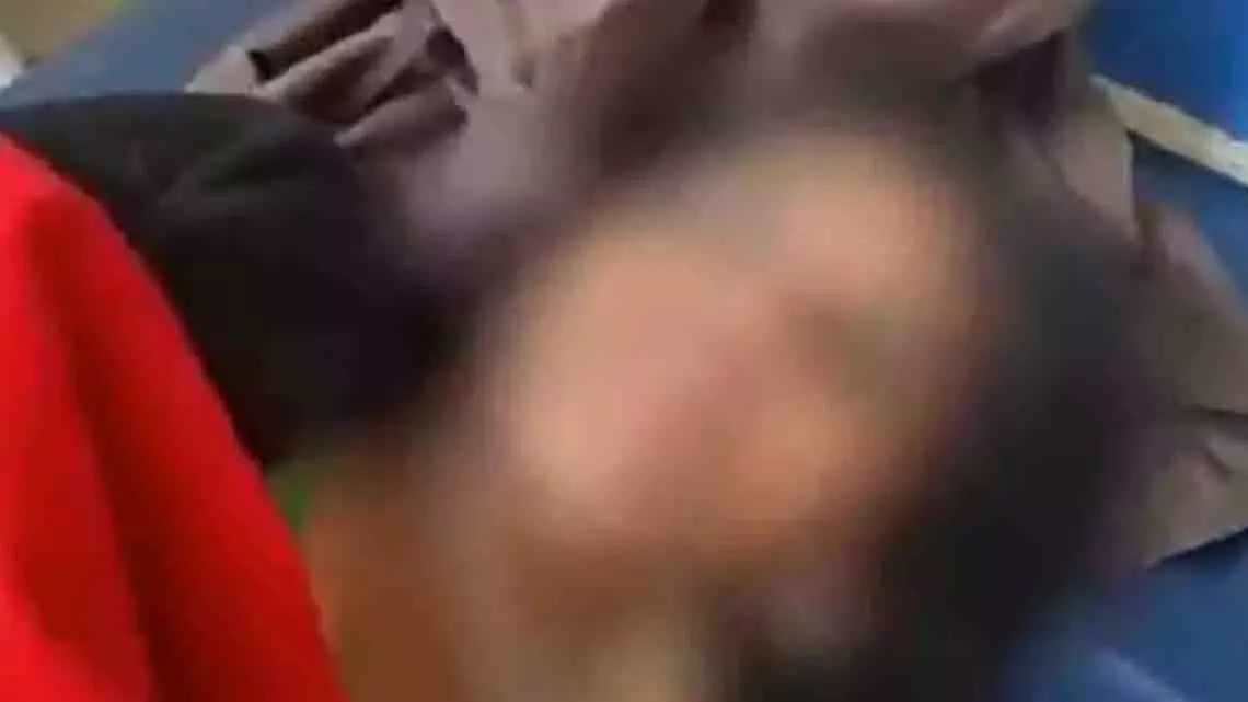 Hathras में महिला ने शादी प्रस्ताव ठुकराने के बाद आत्महत्या की कोशिश Hathras में महिला ने शादी प्रस्ताव ठुकराने के बाद आत्महत्या की कोशिश