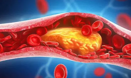 अगर आपको हाई Cholesterol की समस्या है तो ये टिप्स अपनाएं अगर आपको हाई Cholesterol की समस्या है तो ये टिप्स अपनाएं