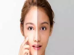 Rice Flour and Potato Face Pack:स्किन करेगी शीशे जैसी शाइन, ट्राय करें ये जादुई फेस पैक Rice Flour and Potato Face Pack:स्किन करेगी शीशे जैसी शाइन, ट्राय करें ये जादुई फेस पैक