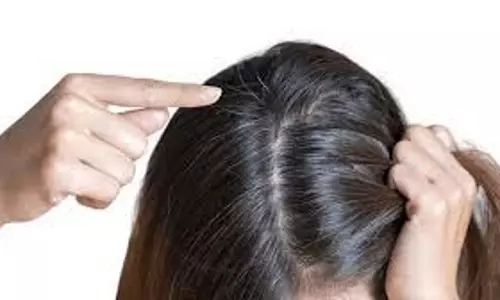 Hair Color : बालों को जड़ से काला कर सकती है सिर्फ एक चुटकी हल्दी, ऐसे करें प्रयोग Hair Color : बालों को जड़ से काला कर सकती है सिर्फ एक चुटकी हल्दी, ऐसे करें प्रयोग