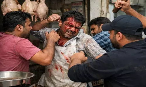 बिलाल नगर में चिकन दुकान संचालक से मारपीट, FIR दर्ज