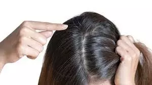Hair Color : बालों को जड़ से काला कर सकती है सिर्फ एक चुटकी हल्दी, ऐसे करें प्रयोग Hair Color : बालों को जड़ से काला कर सकती है सिर्फ एक चुटकी हल्दी, ऐसे करें प्रयोग