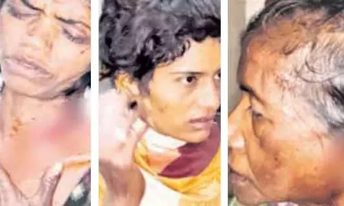 Digapahandi चाकू से हमले में मां और दो बेटियां घायल, संदिग्ध हिरासत में Digapahandi चाकू से हमले में मां और दो बेटियां घायल, संदिग्ध हिरासत में