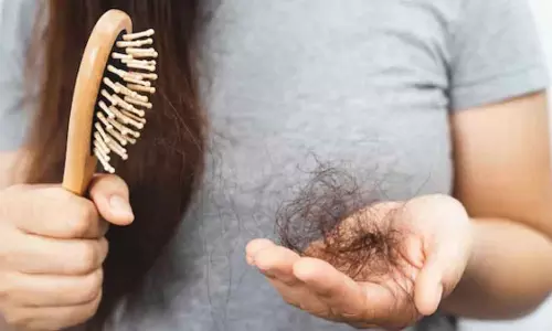 Hair loss : कब सामान्य है और कब चिंता की जरूरत