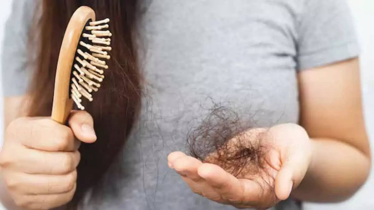 Hair loss : कब सामान्य है और कब चिंता की जरूरत Hair loss : कब सामान्य है और कब चिंता की जरूरत