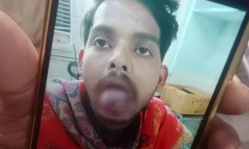 पति को घायल करने वाली पत्नी गिरफ्तार, इंस्टाग्राम रील के चलते परिवार में कलह पति को घायल करने वाली पत्नी गिरफ्तार, इंस्टाग्राम रील के चलते परिवार में कलह