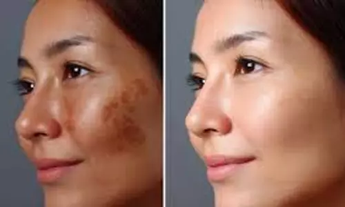 Skin Care Tips: ये एक नुस्खा गायब कर देगा चेहरे के दाग-धब्बे, आजमाकर जरूर देखें Skin Care Tips: ये एक नुस्खा गायब कर देगा चेहरे के दाग-धब्बे, आजमाकर जरूर देखें