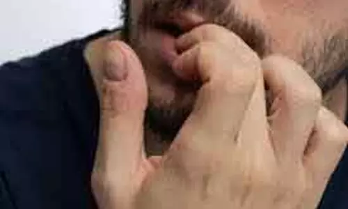 नाखून चबाना: सिर्फ आदत नहीं, Health पर भी असर नाखून चबाना: सिर्फ आदत नहीं, Health पर भी असर