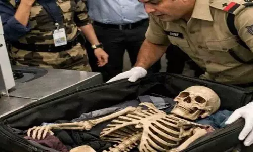 Delhi Airport के लगेज में मिला इंसानी कंकाल मेडिकल डेमो मॉडल Delhi Airport के लगेज में मिला इंसानी कंकाल मेडिकल डेमो मॉडल
