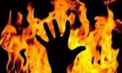 Patna: एकतरफा प्यार में युवक ने नाबालिग पर पेट्रोल डालकर जिंदा जलाया Patna: एकतरफा प्यार में युवक ने नाबालिग पर पेट्रोल डालकर जिंदा जलाया