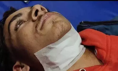 Barnala में बैन चीनी पतंग की डोर से तीन लोग घायल, मुक्तसर में दो लोग घायल Barnala में बैन चीनी पतंग की डोर से तीन लोग घायल, मुक्तसर में दो लोग घायल