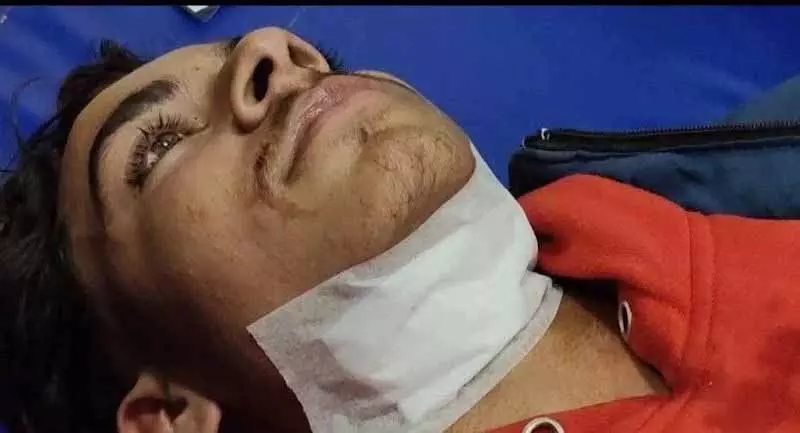 Barnala में बैन चीनी पतंग की डोर से तीन लोग घायल, मुक्तसर में दो लोग घायल Barnala में बैन चीनी पतंग की डोर से तीन लोग घायल, मुक्तसर में दो लोग घायल