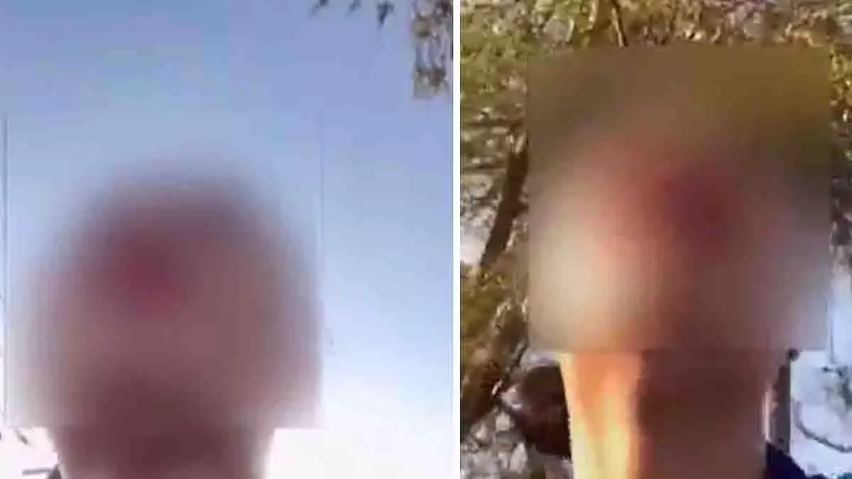 Bengaluru: महिला का आरोप—सड़क पर कार में बैठे नग्न व्यक्ति ने किया पीछा Bengaluru: महिला का आरोप—सड़क पर कार में बैठे नग्न व्यक्ति ने किया पीछा