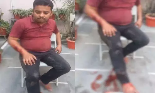 रायपुर में फिर पिटबुल डॉग का आतंक, युवक पर हमला, रहवासी दहशत में रायपुर में फिर पिटबुल डॉग का आतंक, युवक पर हमला, रहवासी दहशत में