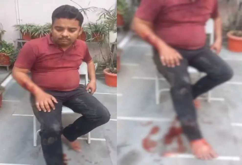 रायपुर में फिर पिटबुल डॉग का आतंक, युवक पर हमला, रहवासी दहशत में रायपुर में फिर पिटबुल डॉग का आतंक, युवक पर हमला, रहवासी दहशत में