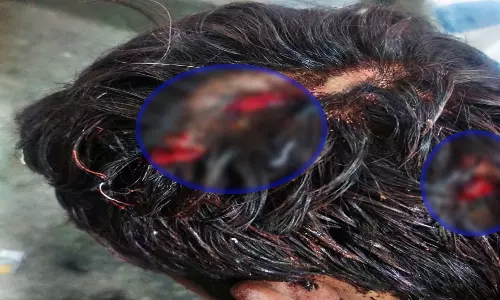 रायपुर में गणतंत्र दिवस के दिन युवक से लूटपाट और मारपीट रायपुर में गणतंत्र दिवस के दिन युवक से लूटपाट और मारपीट