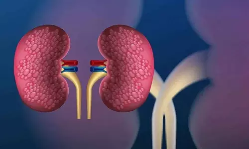 अगर आपको ये लक्षण दिखें तो Kidney की बीमारियों से बचने के लिए आपको डॉक्टर से सलाह लेनी चाहिए