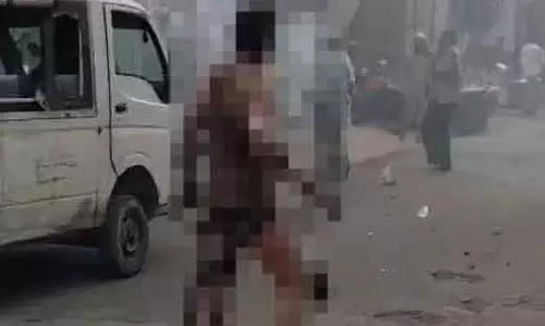 MP : रतलाम में बंदूक की दुकान में धमाके से 4 लोग बुरी तरह झुलसे MP : रतलाम में बंदूक की दुकान में धमाके से 4 लोग बुरी तरह झुलसे