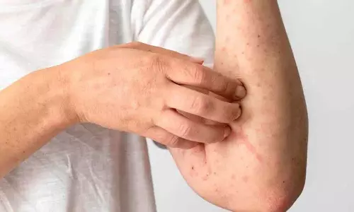 अगर आपको Liver की बीमारियां हैं तो ये लक्षण दिखाई देंगे