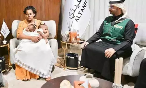 Tanzania  की जुड़वां बच्चियां रियाद में मेडिकल जांच के लिए पहुंचीं