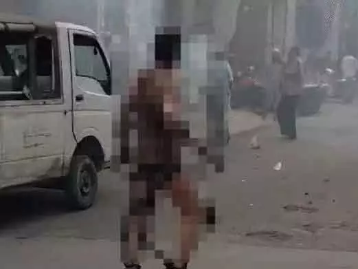 MP : रतलाम में बंदूक की दुकान में धमाके से 4 लोग बुरी तरह झुलसे MP : रतलाम में बंदूक की दुकान में धमाके से 4 लोग बुरी तरह झुलसे