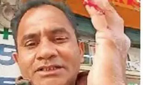 Phagwara में चीनी डोर से बाइकर की उंगली कटी