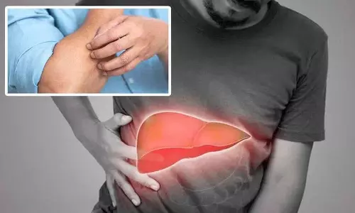अगर आपको Liver की बीमारी है तो आपकी त्वचा पर ये लक्षण दिखेंगे