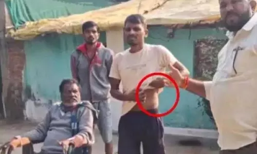 कर्ज चुकाने के लिए आदमी ने अपनी Kidney बेची, लेकिन एक महीने से ज़्यादा समय से न्याय में देरी हो रही कर्ज चुकाने के लिए आदमी ने अपनी Kidney बेची, लेकिन एक महीने से ज़्यादा समय से न्याय में देरी हो रही