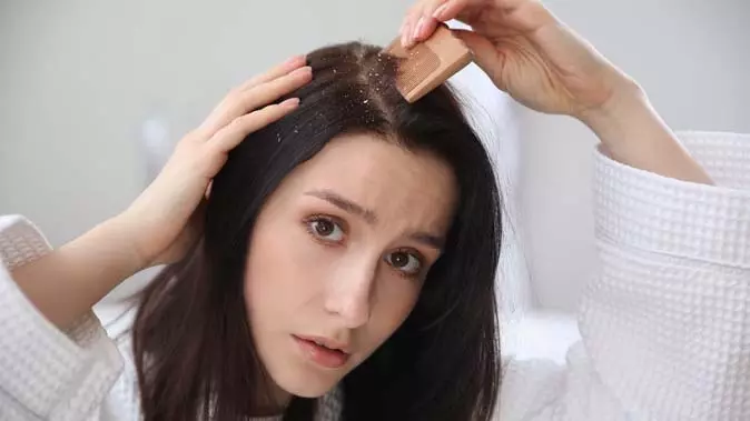 Cause Of Dandruff: डैंड्रफ अगर बार-बार लौट आता है, तो ये गलतियां हो सकती हैं वजह Cause Of Dandruff: डैंड्रफ अगर बार-बार लौट आता है, तो ये गलतियां हो सकती हैं वजह