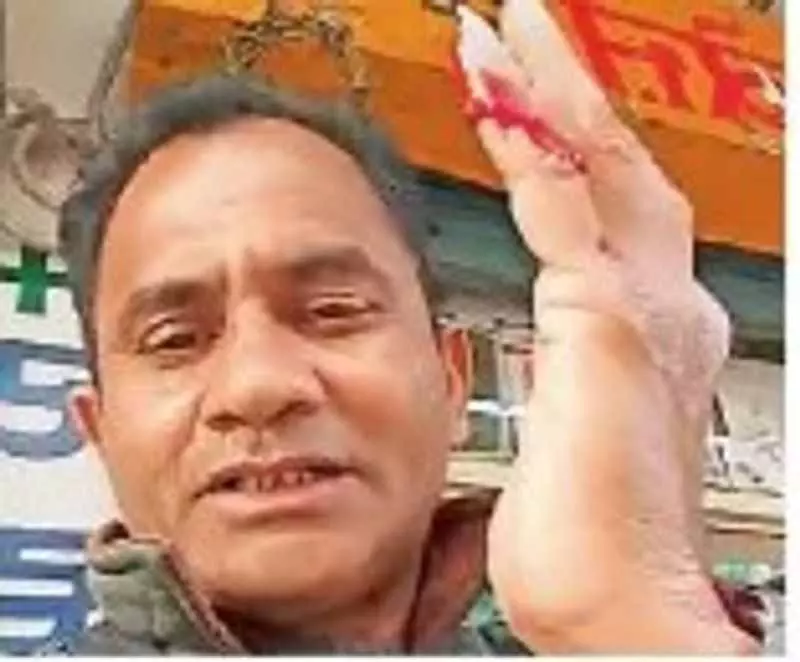 Phagwara में चीनी डोर से बाइकर की उंगली कटी Phagwara में चीनी डोर से बाइकर की उंगली कटी