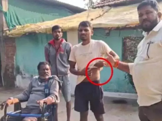 कर्ज चुकाने के लिए आदमी ने अपनी Kidney बेची, लेकिन एक महीने से ज़्यादा समय से न्याय में देरी हो रही कर्ज चुकाने के लिए आदमी ने अपनी Kidney बेची, लेकिन एक महीने से ज़्यादा समय से न्याय में देरी हो रही
